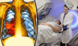 Lung-cancer-drug-Pembrolizumab-has-been-approved-for-use-on-the-NHS-by-NICE-739195