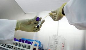 Plague-Madagascar-TVCNews