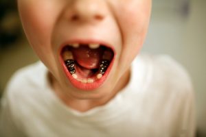 ‘Baby teeth DO matter’