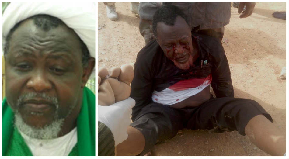 ”I am alive and getting better, thanks to all your prayers” – Sheikh El-Zakzaky
