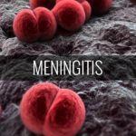 Meningitis-TVCNews