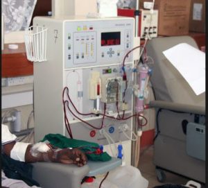 Dialysis