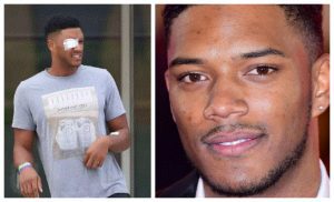 MTV Star Theo Campbell left blind in one eye after champagne cork accident