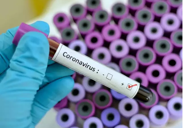 Senegal is second country in Sub-saharan Africa to confirm case of Corona virus
