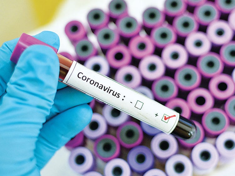 BREAKING: Nigeria confirms 10 new cases of Coronavirus