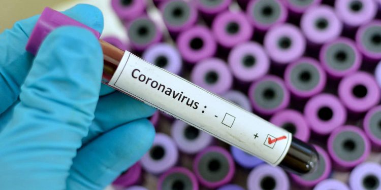 Taraba records six cases of Coronavirus