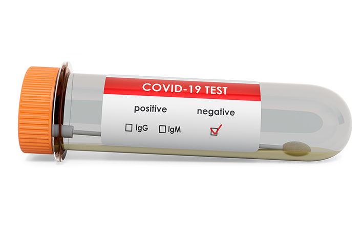 Two COVID-19 patients test negative in Enugu