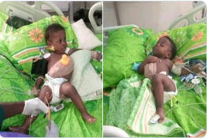 Separated_twins_750x499