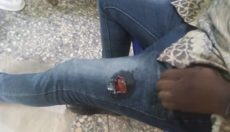 Police shoot the Nation Newspaper’s Correspondent in Osun