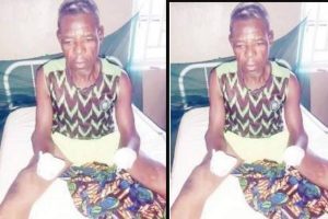 Bandits cut off Zamfara man’s arms, cart away chicken