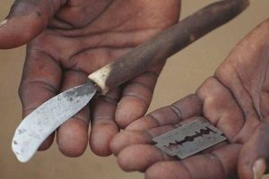 FEMALE GENITAL MUTILATION