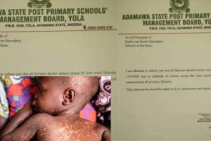 Adamawa extends schools resumption by one week amid measles outbreak