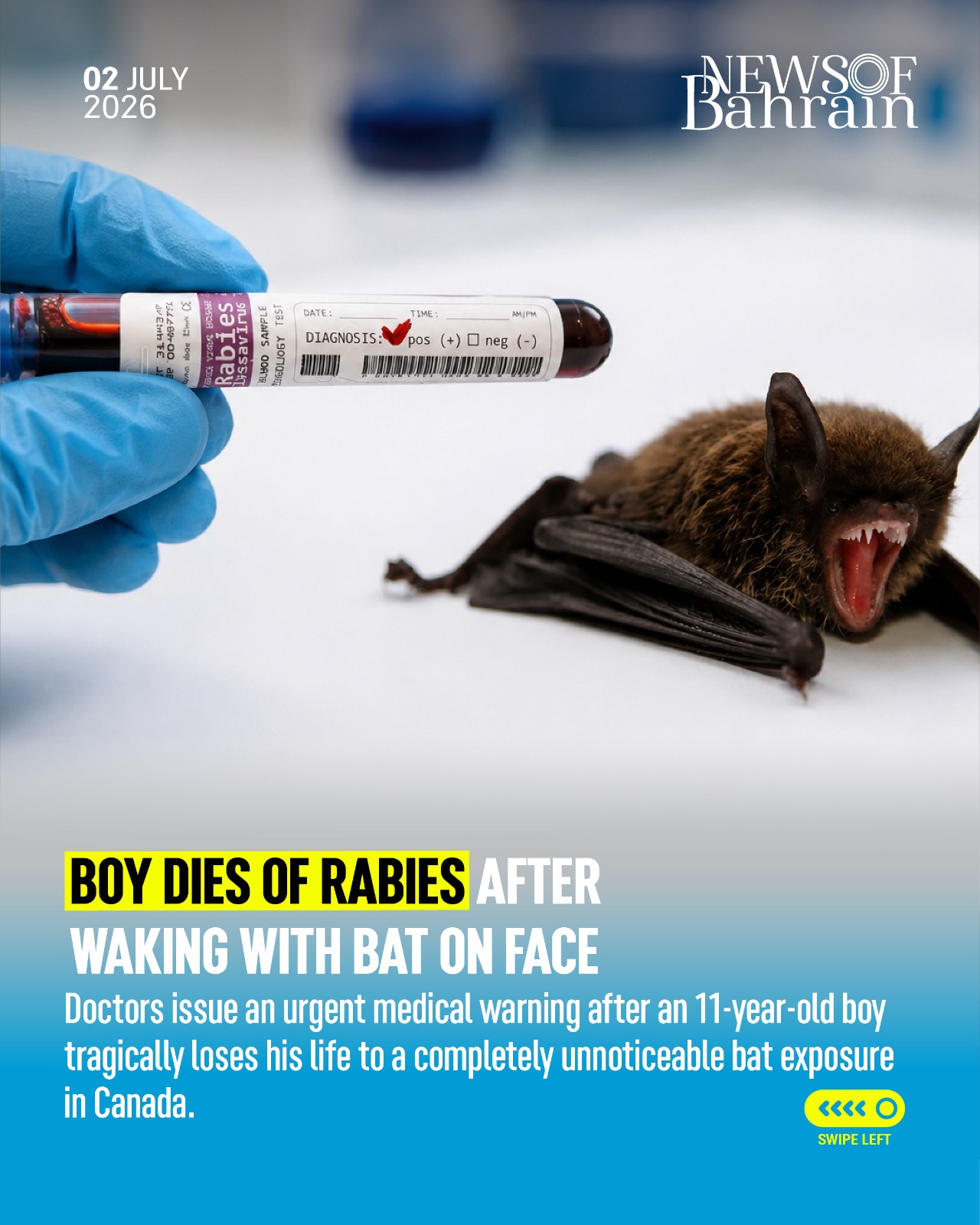 Canadian Boy Dies Of Rabies After Waking Up With Bat On His Face Canadian Boy Dies Of Rabies After Waking Up With Bat On His Face